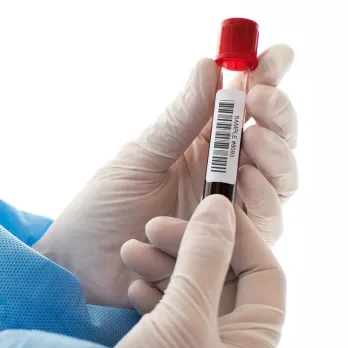 Medical professional in glove holding test tube with barcode label