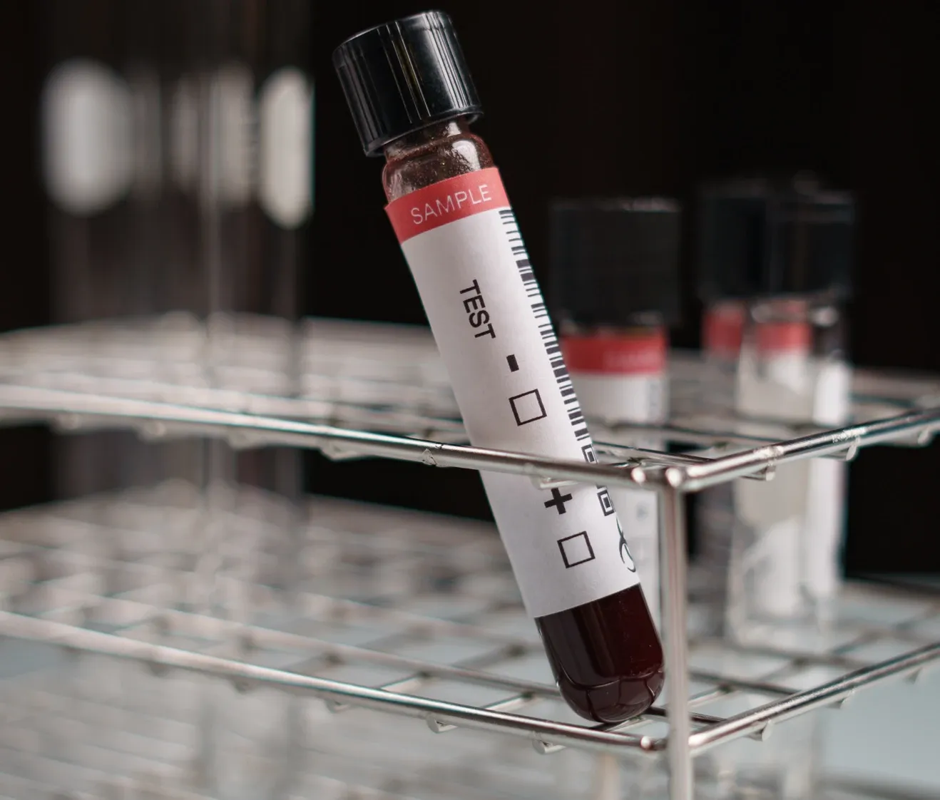 labeled test tubes in a rack