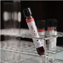 a gloved hand pulls a labeled test tube out of a test tube holder